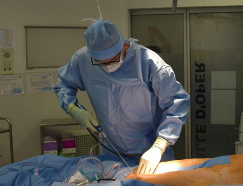 Dieta Pós-Operatório: Nutrição Essencial na Lipo com Plasma